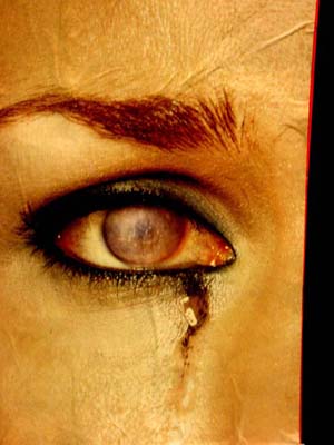 eye%20cry.jpg